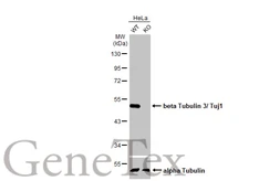 Anti-beta Tubulin 3/ Tuj1 antibody [HL1709] used in Western Blot (WB). GTX637308