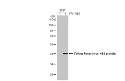 Anti-Yellow Fever virus NS5 protein antibody [HL2916] used in Western Blot (WB). GTX640259